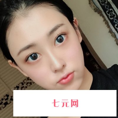 海南韩美杨芒利做鼻子怎么样？全新体验实例曝光