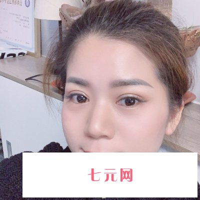 中山三院颜玲眼综合实例公开|成果自然美观