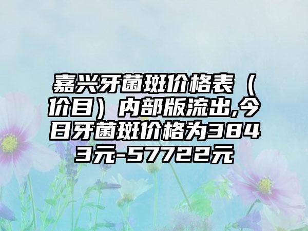 嘉兴牙菌斑价格表（价目）内部版流出,今日牙菌斑价格为3843元-57722元