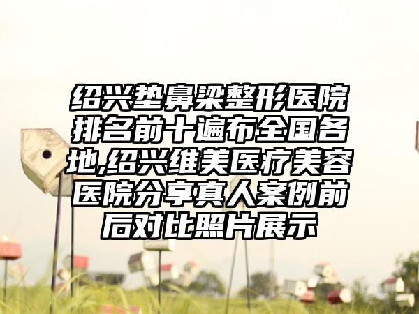 绍兴垫鼻梁整形医院排名前十遍布全国各地,绍兴维美医疗美容医院分享真人实例前后对比照片展示