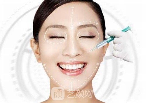 伊妍仕少女针维持时间是多久？使用方法以及优势介绍