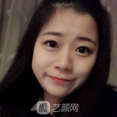 南京韩辰美容医院正规吗?全新隆鼻实例出炉