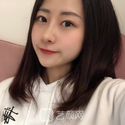 南京韩辰美容医院正规吗?全新隆鼻实例出炉