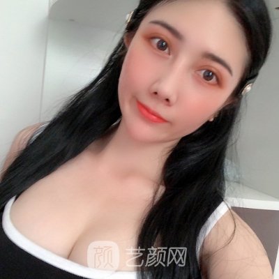 昆明吴氏嘉美整形医院正规吗?2023隆胸实例上线