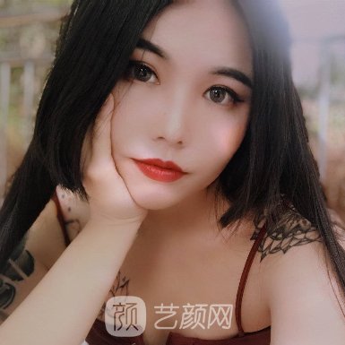 北京李敏做修复双眼皮怎么样? 2023全新体验实例公布