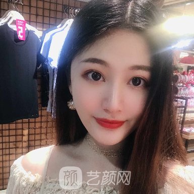 八大处李海东医生注射除皱实例公开2023体验实例上线