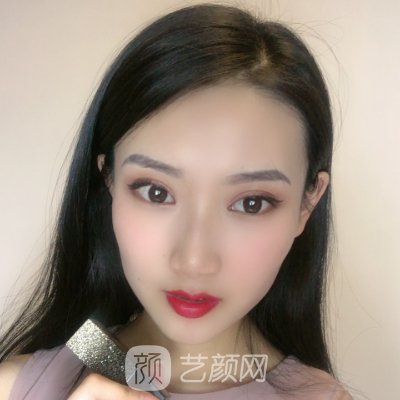 上海久雅整形医院割双眼皮靠谱吗?90天招牌实例一览