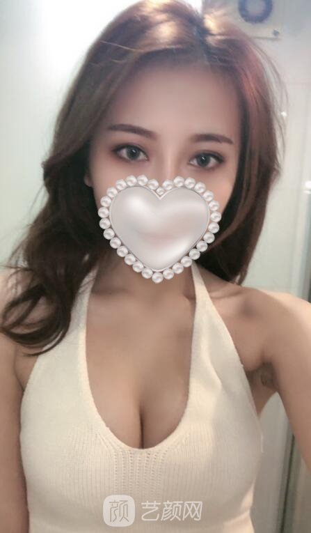 成都后美整形医院怎么样？医生介绍|价格表|隆胸实例