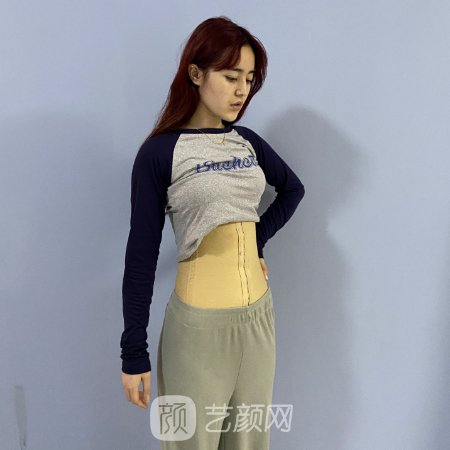 沈阳恩喜整形医院吸脂实例上线|附体验对比图