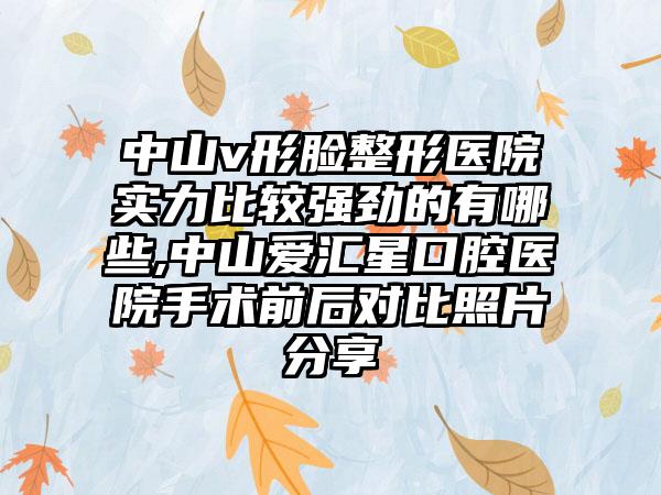 中山v形脸整形医院实力比较强劲的有哪些,中山爱汇星口腔医院手术前后对比照片分享