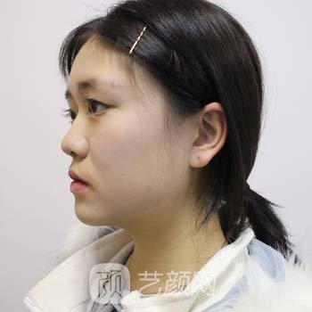 上海铭昊整形医院地址在哪？技术怎么样？全新价目表更新