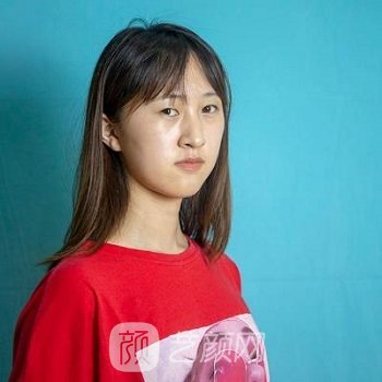 代忠洪做的帕克8度美眼实例，营造自然无痕靓丽大眼睛