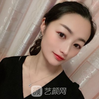 上海美莱吴海龙医生口碑怎么样？做双眼皮靠谱吗？附实例