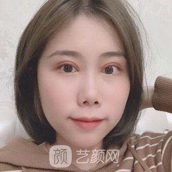 上饶IG肖发财医疗美容门诊部怎么样？收费明细表+实例