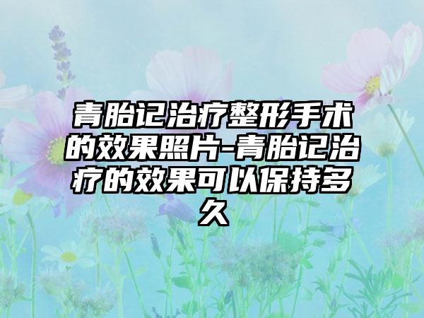 青胎记治疗整形手术的成果照片-青胎记治疗的成果可以保持多久