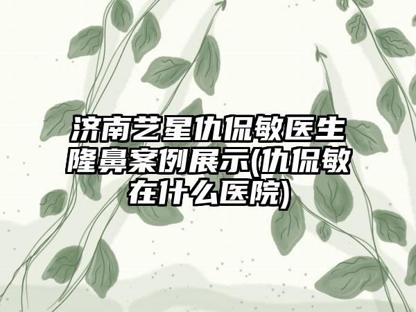 济南艺星仇侃敏医生隆鼻实例展示(仇侃敏在什么医院)