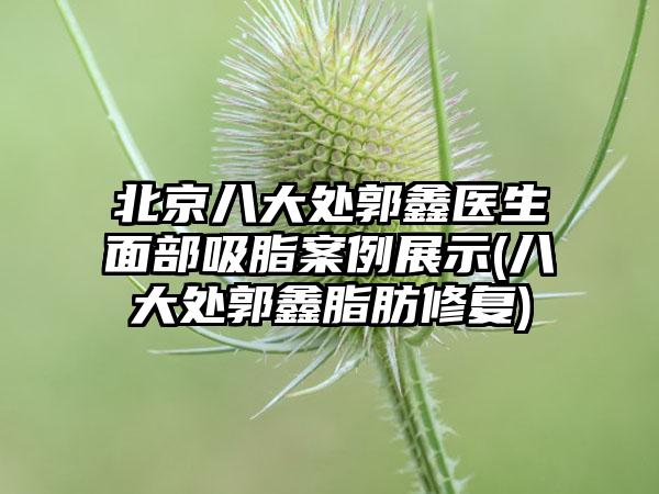 北京八大处郭鑫医生面部吸脂实例展示(八大处郭鑫脂肪修复)