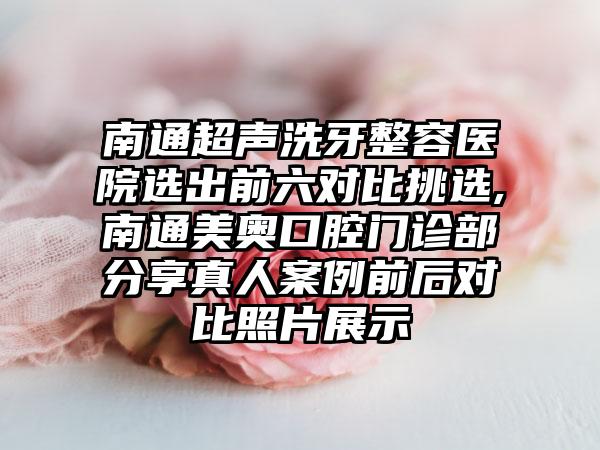 南通超声洗牙整容医院选出前六对比挑选,南通美奥口腔门诊部分享真人实例前后对比照片展示