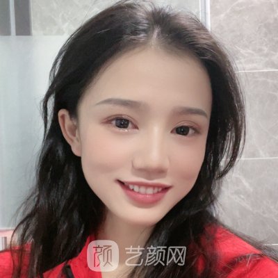 北京禾美嘉整形美容医院正规吗? 全新玻尿酸面部除皱实例一览