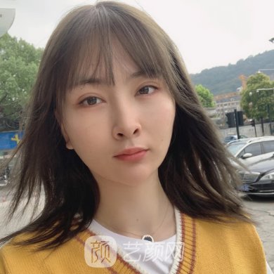 兰大二院整形科刘凯做玻尿酸面部除皱好吗?亲测实例曝光