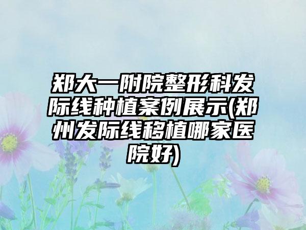 郑大一附院整形科发际线种植实例展示(郑州发际线移植哪家医院好)